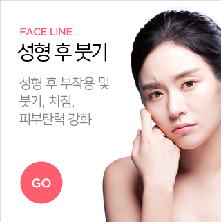 성형후붓기